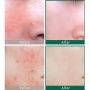 Восстанавливающий крем для проблемной кожи Some By Mi AHA-BHA-PHA 30 Days Miracle Cream, 60g