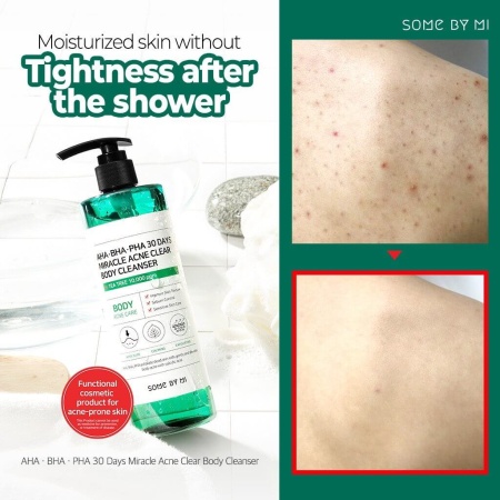 Очищающий гель для проблемной кожи тела AHA, BHA, PHA 30 Days Miracle Acne Clear Body Cleanser